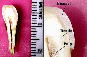 section de dent